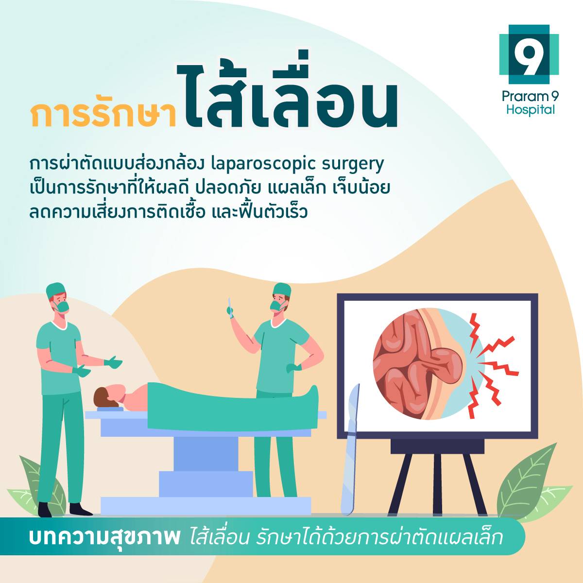 การผ่าตัดรักษาไส้เลื่อน