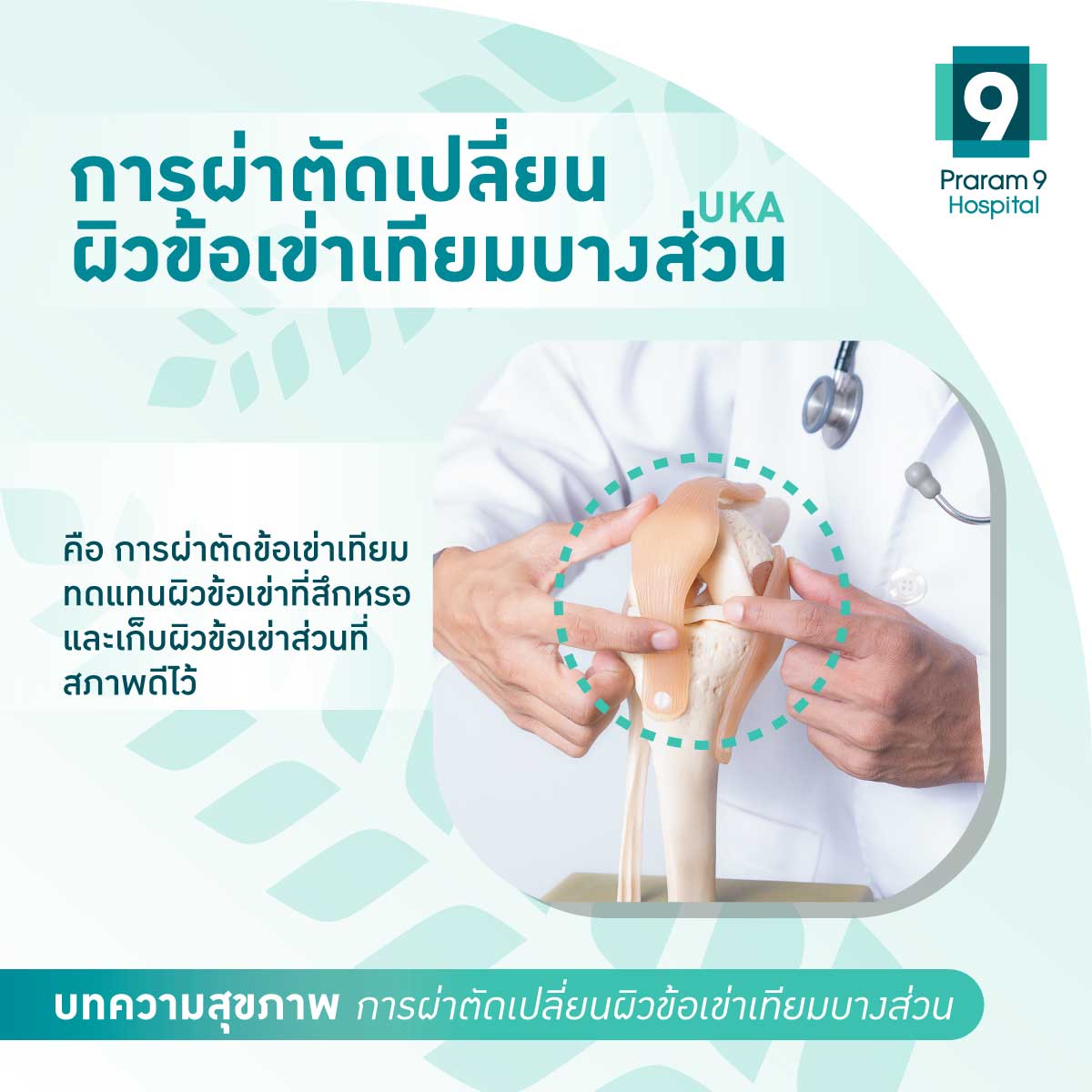 ผ่าตัดเปลี่ยนผิวข้อเข่าเทียมบางส่วนคืออะไร
