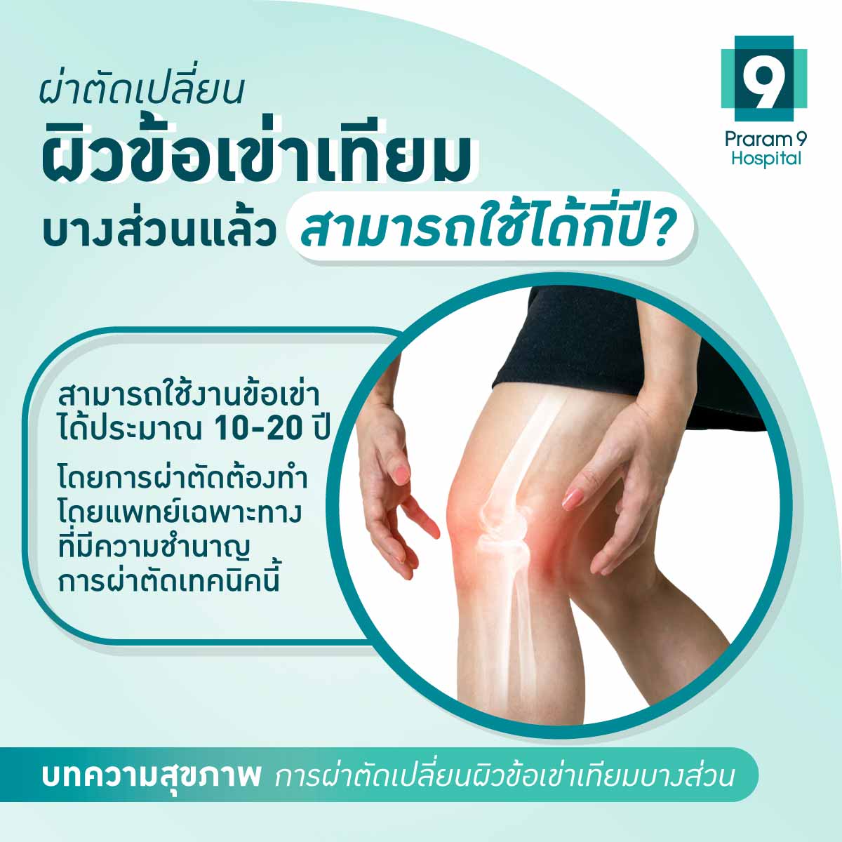 การผ่าตัดเปลี่ยนผิวข้อเข่าเทียม สามารถใช้งานได้กี่ปี