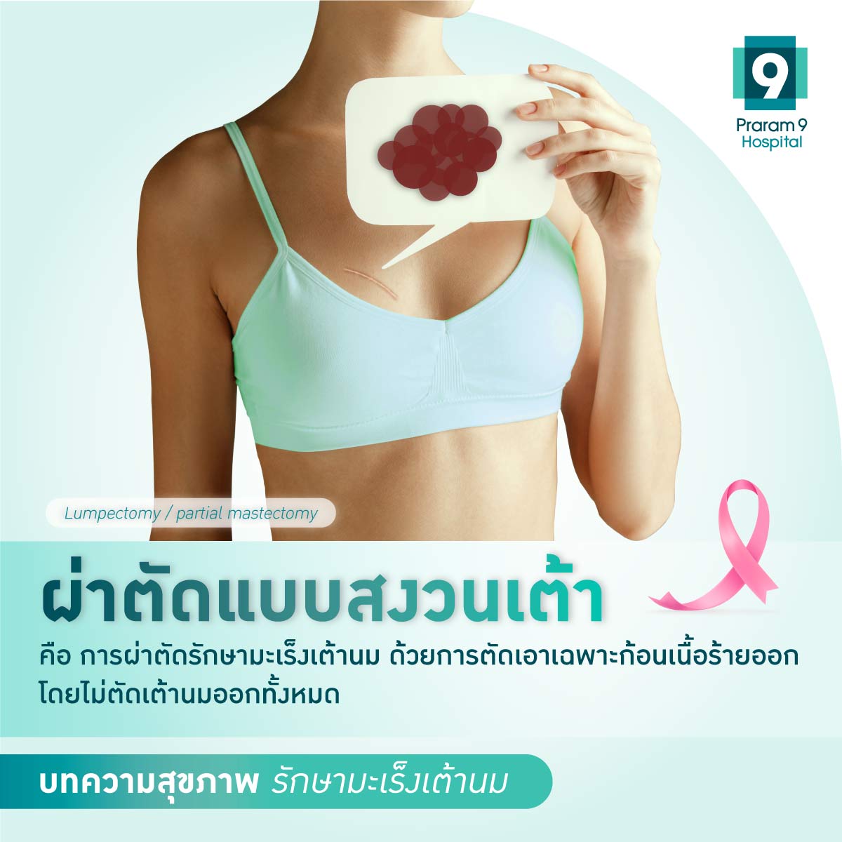 ผ่าตัดแบบสงวนเต้า