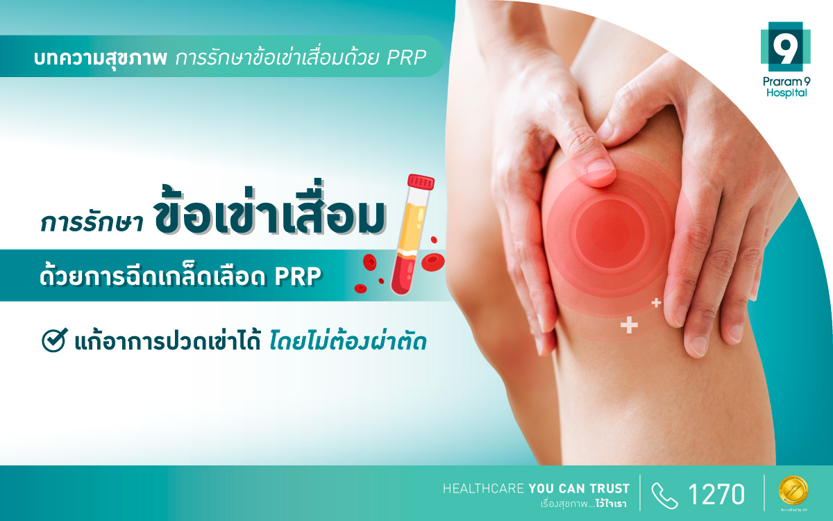 การรักษาข้อเข่าเสื่อมด้วยการฉีดเกล็ดเลือด PRP