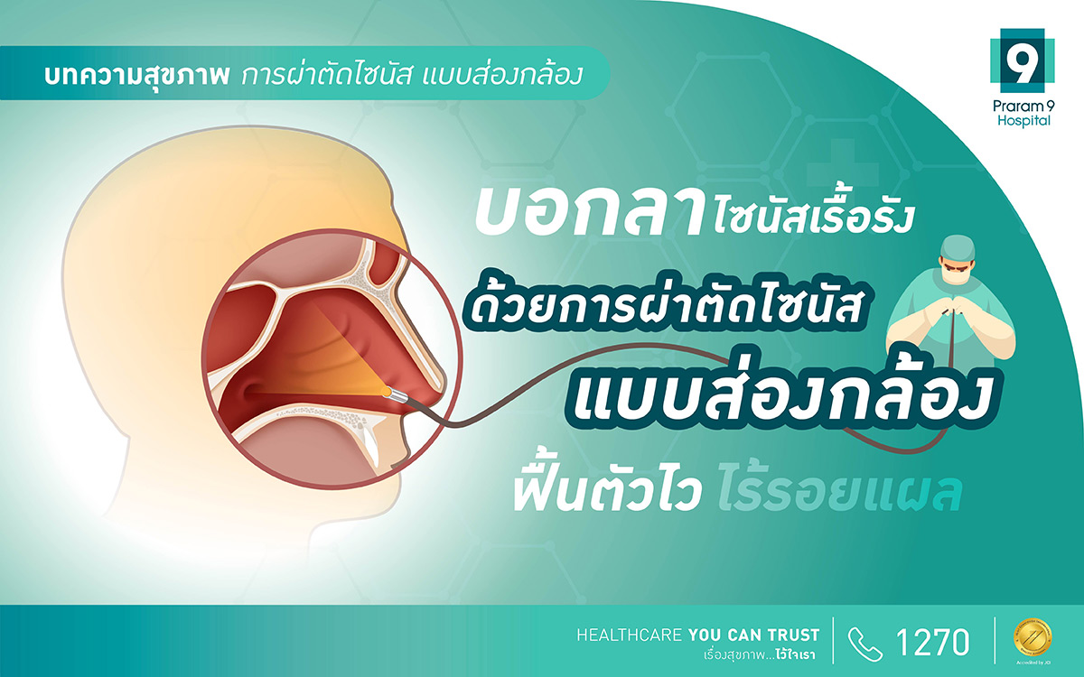 การผ่าตัดไซนัสแบบส่องกล้อง