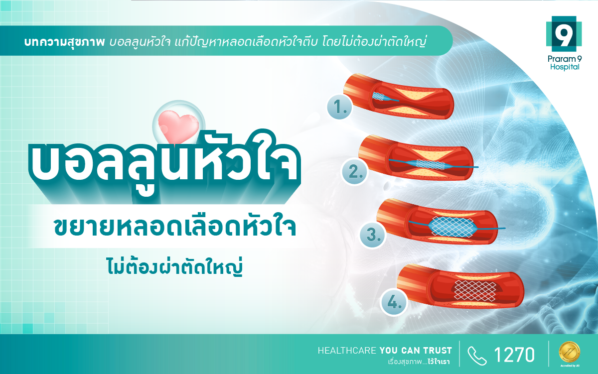 บอลลูนหัวใจ