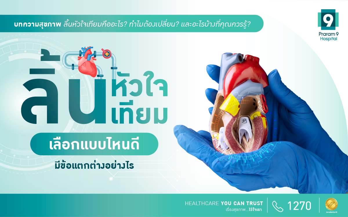 ลิ้นหัวใจเทียม